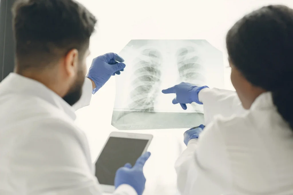 Rib Remodeling Before and After
