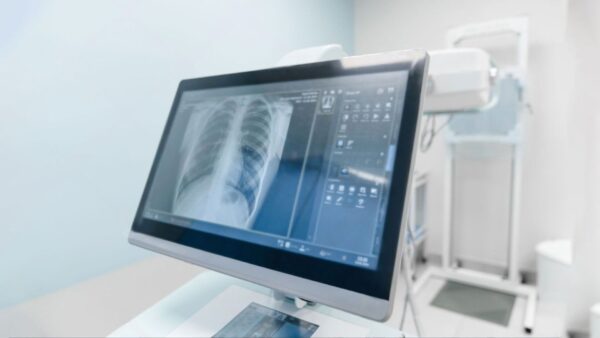 Rib Remodeling Surgery