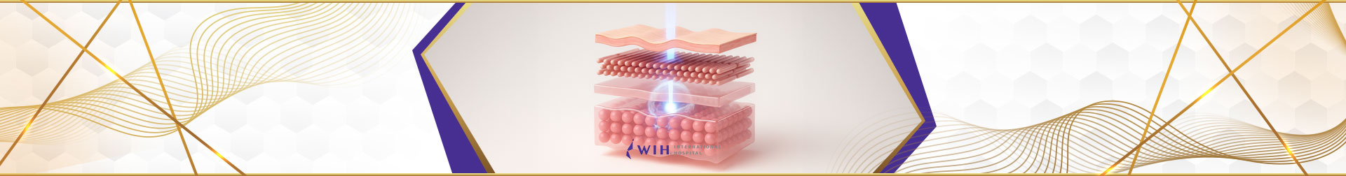 Ulthera Non-Surgical Skin Lifting