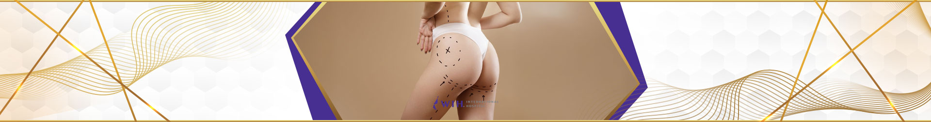 Hip Liposuction: Reshaping Your Silhouette