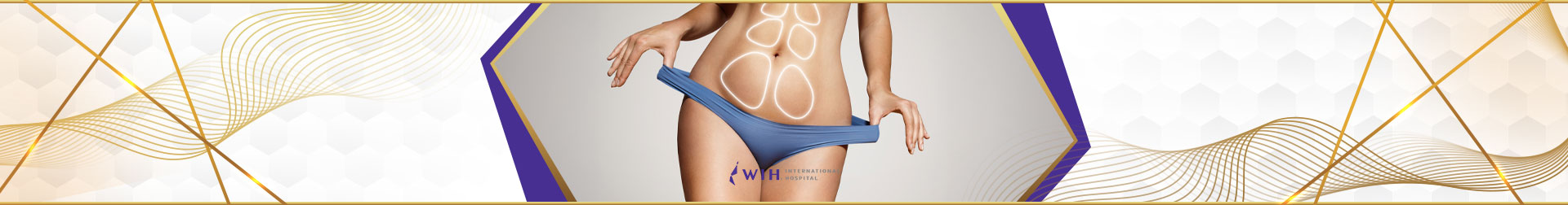 Fleur-de-lis Tummy Tuck