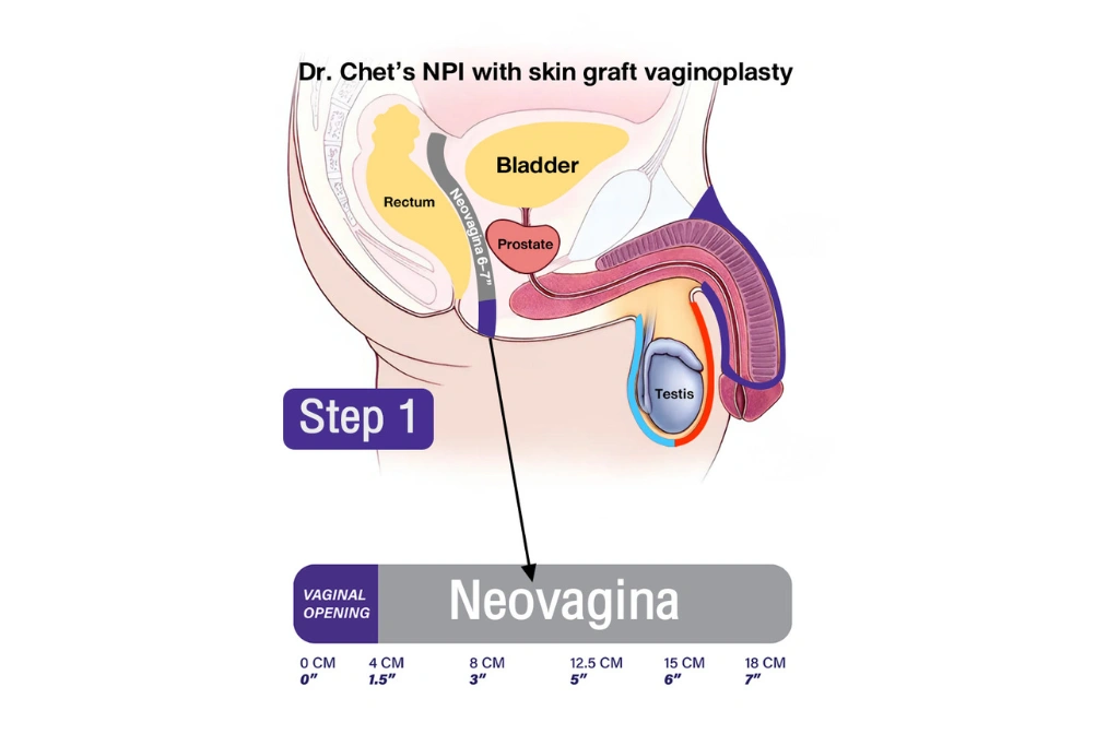 skin-graft-article-wih international hospital, Thailand