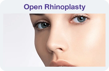 Thread Lift Procedures