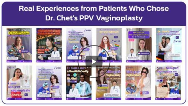 ppv-vaginoplasty-wih-webp