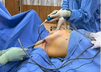 transgender-operation-surgery